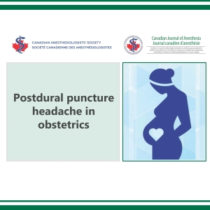 Postdural puncture headache in obstetrics