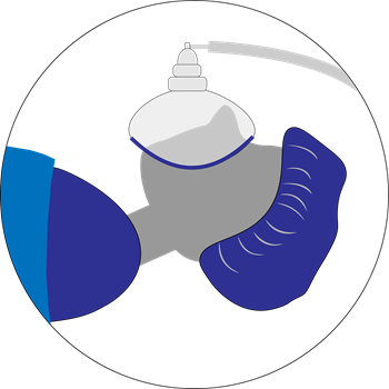 General-Anesthesia-(1).png